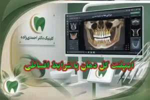هزینه ایمپلنت کل دهان
