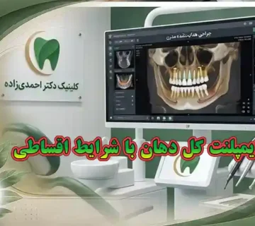 هزینه ایمپلنت کل دهان