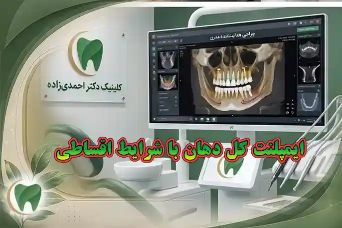 هزینه ایمپلنت کل دهان