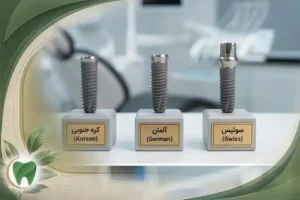 مقایسه قیمت ایمپلنت کرهای، آلمانی و سوئیسی