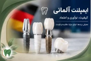 ایمپلنت آلمانی