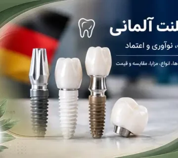 ایمپلنت آلمانی