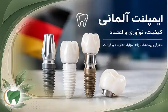 ایمپلنت آلمانی