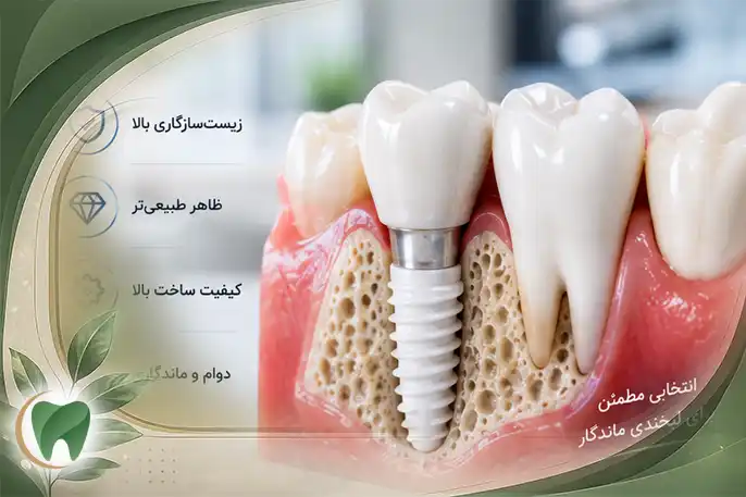 ایمپلت آلمانی چه برندی داشت؟