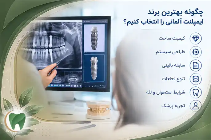 ایمپلنت آلمانی